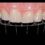 Planificare Dig. si Digital Smile Design / OPTISTUD